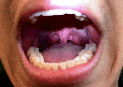 Winter reccomend japanese girl uvula tickled