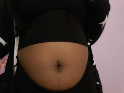 Kicks reccomend milk bloat belly